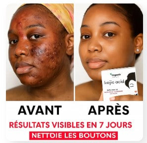 Savons Kojic –Purifie, Nettoie et Illumine Visiblement la Peau