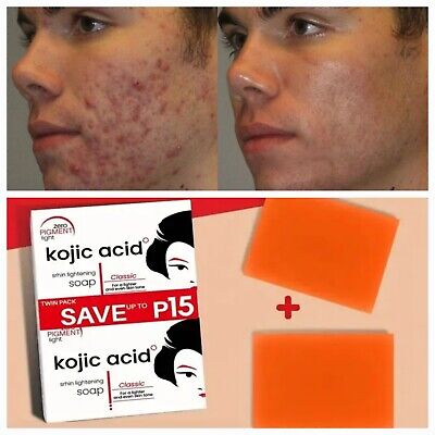 Savons Kojic –Purifie, Nettoie et Illumine Visiblement la Peau